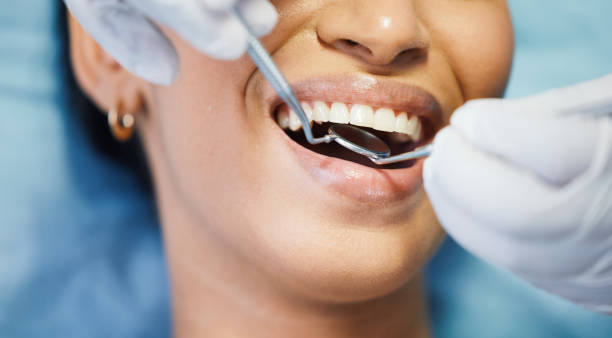 Best Broken Tooth Emergency  in Matteson, IL